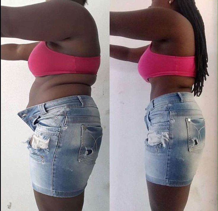 Antes e depois de cliente Dietapp